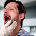 Nu au fumat niciodată, dar au făcut cancer oral. Semnalele de alarmă pe care tinerii le ignoră