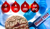 Studiu: grupa ta de sânge ar putea prezice riscul de a avea un accident vascular cerebral înainte de vârsta de 60 de ani