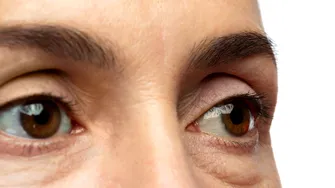 Ochi umflați: când este o problemă minoră și când trebuie să mergi la medic