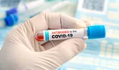 Test anticorpi neutralizanți – îți arată dacă și câți anticorpi ai dezvoltat după vaccinarea împotriva COVID-19