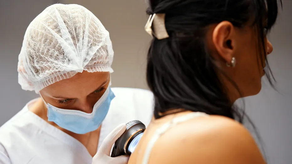 Hidradenita supurativă. Semne de avertizare și la ce să fii atent