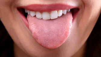 Ce spune culoarea limbii despre starea ta de sănătate