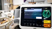 Puls sub 60 de bătăi pe minut? Cardiologii explică când este perfect normal și când poate ascunde o problemă de ritm cardiac