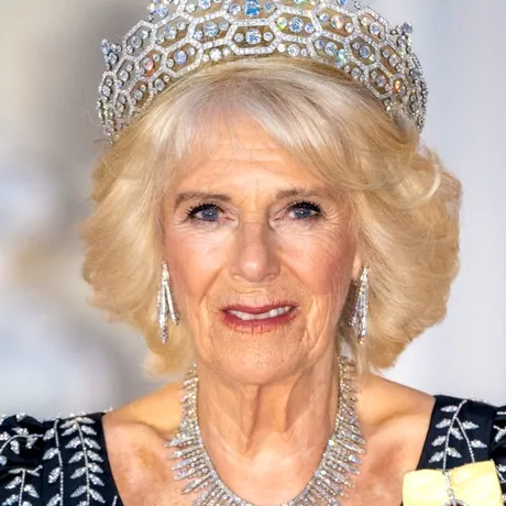 Ce este sinuzita acută? Afecțiunea de care suferă Regina Camilla