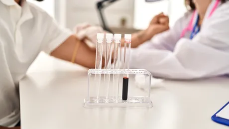 Poate o simplă analiză de sânge să arate cancerul? Ce trebuie să știi despre hemogramă