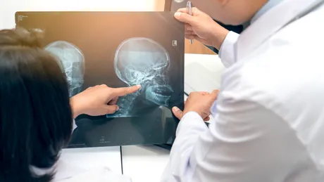 Cum se manifestă cancerele de cap și gât și cum trebuie tratate?