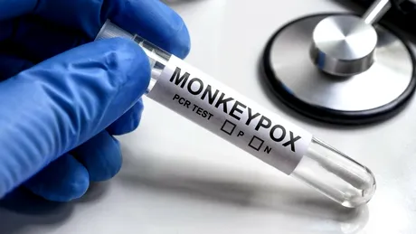 5 zvonuri complet eronate despre variola maimuței