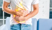 10 remedii naturale care alină arsurile la stomac și indigestia