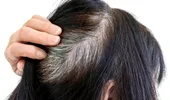 Ce să mănânci ca să întârzii albirea părului