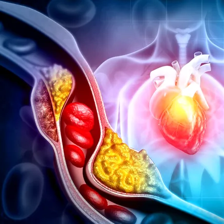 Un cardiolog dezvăluie 5 alimente pe care le consumă ca să țină colesterolul scăzut și inima „sănătoasă”