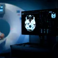 Ce au descoperit medicii când i-au făcut un CT unui bărbat în vârstă de 70 de ani