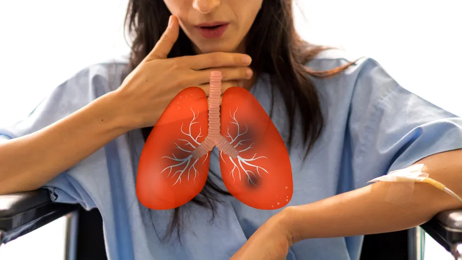 Boala cauzată de poluare care bagă mii de români în spital. Medic: „1 din 4 pacienți cu această afecțiune dezvoltă cancer pulmonar”
