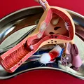 Ce să mănânci dacă ai trecut printr-o histerectomie. Alimente vindecătoare care te ajută să-ți recapeți forța