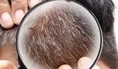 Cercetătorii au descoperit de ce stresul albeşte părul