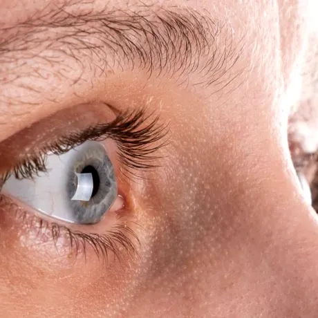 Semnul subtil din sprâncene care anunță o carență