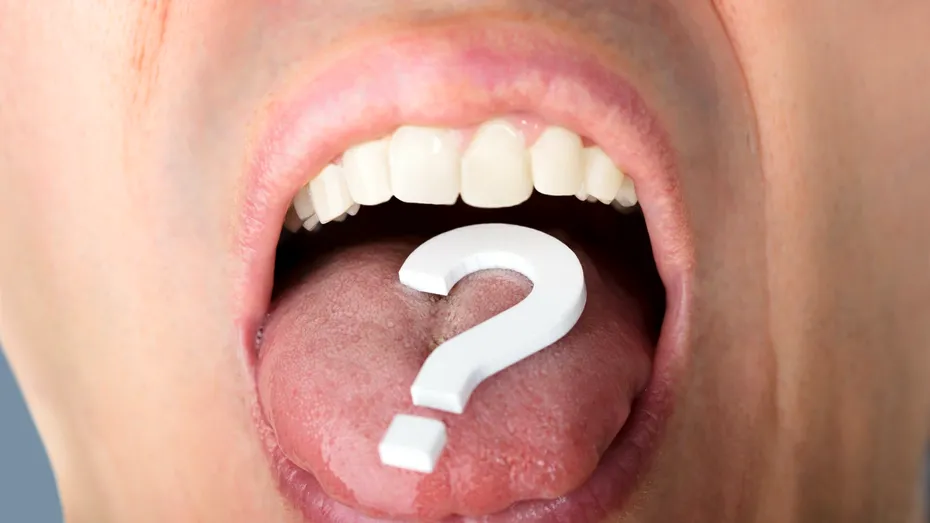 ATENȚIE! Limba neagră păroasă poate fi semnul unei boli extrem de grave