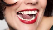10 Obiceiuri ale dinţilor frumoşi