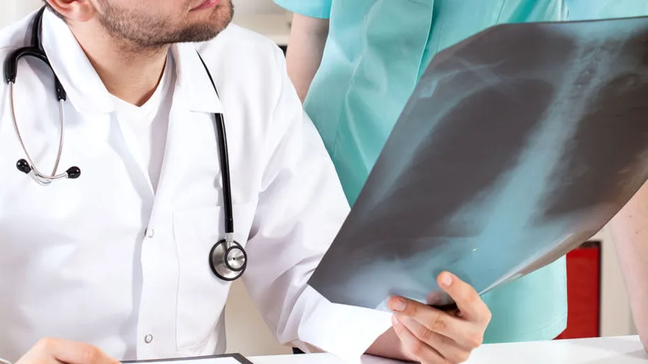 Metastaza, între mit şi realitate