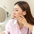 4 alimente care pot agrava acneea, potrivit unui medic dermatolog