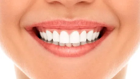 Albirea dentară: 5 lucruri pe care trebuie să le ştii înainte de tratament