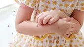 Infecția cu West Nile la copii - 5 semnale de alarmă. Doctor Craiu: „Sunt semne de meningită”