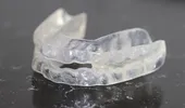 Ce trebuie să știi dacă urmează să porți un aparat dentar invizibil pentru adulți