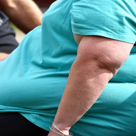 Diagnosticul de obezitate înainte de 30 de ani crește riscul de moarte prematură cu 70%