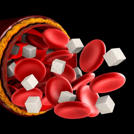 6 condimente salvatoare pentru diabetici. Curăță zahărul din vasele de sânge!
