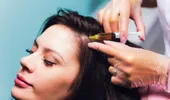 Cum funcționează mezoterapia pentru piele și scalp