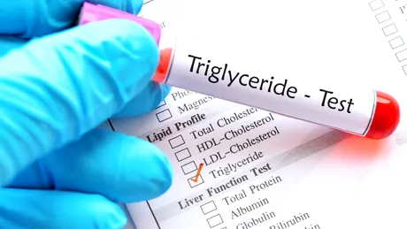 Trigliceride mari - cauze și tratament naturist pentru a le aduce la normal