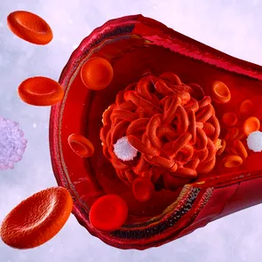 Cinci alimente care curăță arterele și îmbunătățesc circulația sanguină. Cum îți protejezi inima