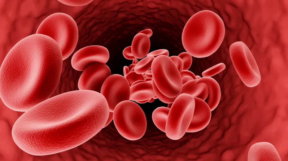 Ateroscleroza, mai răspândită în Europa de Est: interviu cu un expert (II)