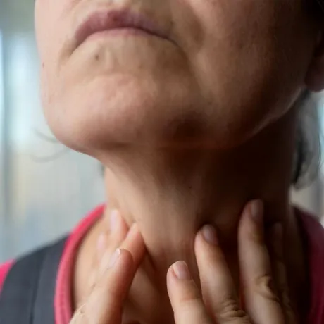 Dieta Hashimoto: cum se schimbă regimul alimentar când ai tiroidă Hashimoto. Alimente permise și interzise