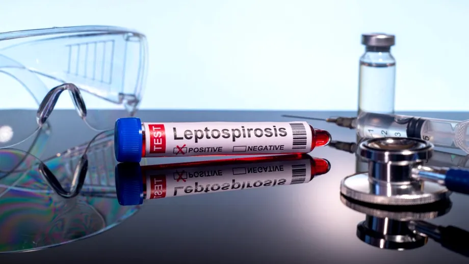 Leptospiroza: boala bacteriană care poate apărea după contactul cu apă contaminată. Cum se transmite, ce simptome are și cum poate fi prevenită
