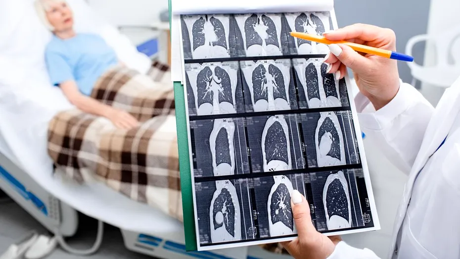 Tipuri de cancer pentru care pacienții solicită investigații de imagistică medicală