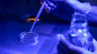 Terapia cu celule stem, o nouă speranță pentru tratarea AVC. Țara noastră are cea mai mare rată de mortalitate prin AVC din Europa