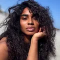 Laurette nu scapă de problemele de sănătate după injectarea cu Aquafilling. Se pregătește de o nouă operație: „Soluția rămasă în picior s-a infectat din nou”