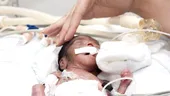 În 2 maternităţi din ţară, părinţii îşi vor putea îngriji bebeluşii prematuri