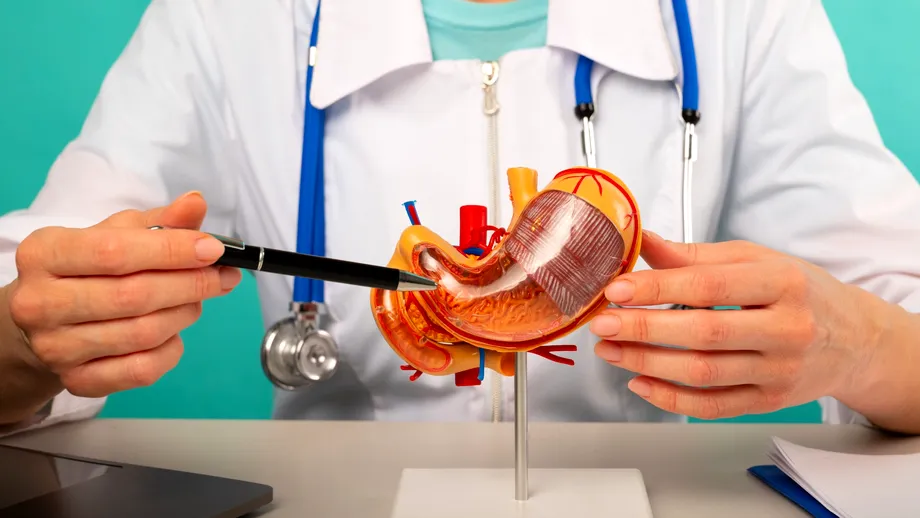 Bypassul gastric, „standard de aur” în tratamentul chirurgical al obezității morbide