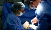Boala frecventă, care poate da complicații severe. Varicele nu sunt doar o problemă de natură estetică