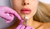 4 adevăruri surprinzătoare despre injecțiile în buze. Numărul 3 te va șoca