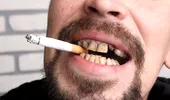 Obiceiurile care distrug dinții românilor – fumatul și consumul de alcool