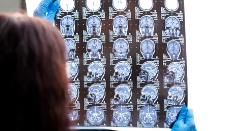 Primul copil vindecat de gliomul trunchiului cerebral, o formă extrem de agresivă de cancer. Povestea incredibilă a lui Lucas