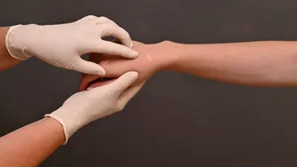 Remediul natural care șterge cicatricile, conform studiilor. Cum funcționează