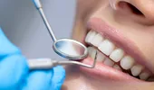 Pătarea dinţilor: cauze şi metode de tratament