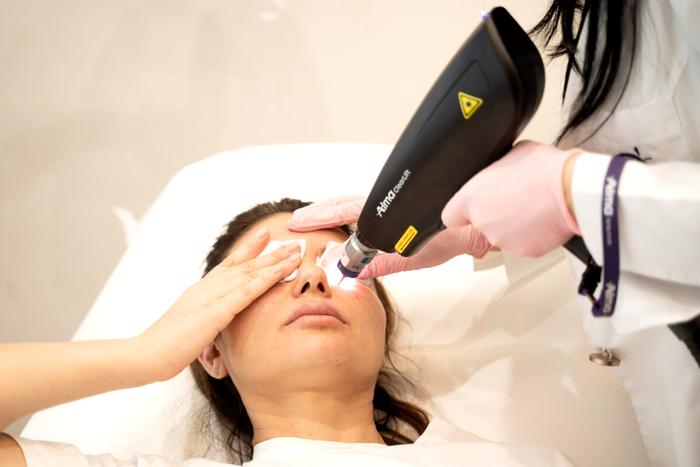 Tratamentele de toamnă care redau luminozitatea pielii – melasmă, pete pigmentare, rozacee și deshidratare