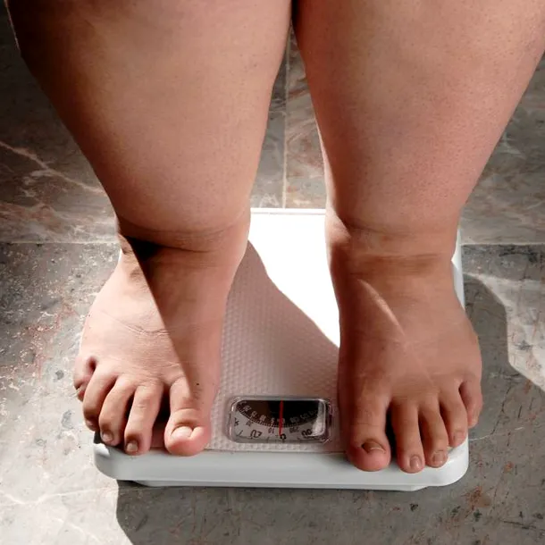 Când dietele nu mai funcționează: cum îți dai seama că ai nevoie de o soluție medicală pentru obezitate