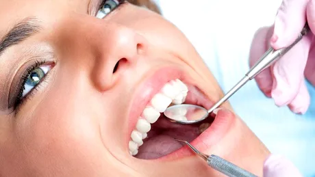 Fațete versus coroane dentare: care ți s-ar potrivi?