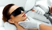 Epilarea cu laser: mituri detronate de dermatologi