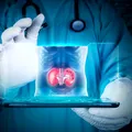 Cum îți poți proteja rinichii în timpul chimioterapiei: recomandări importante pentru pacienții oncologici